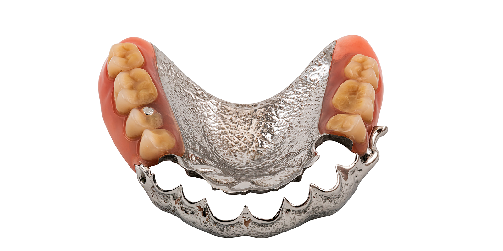 金属床義歯（自費診療）