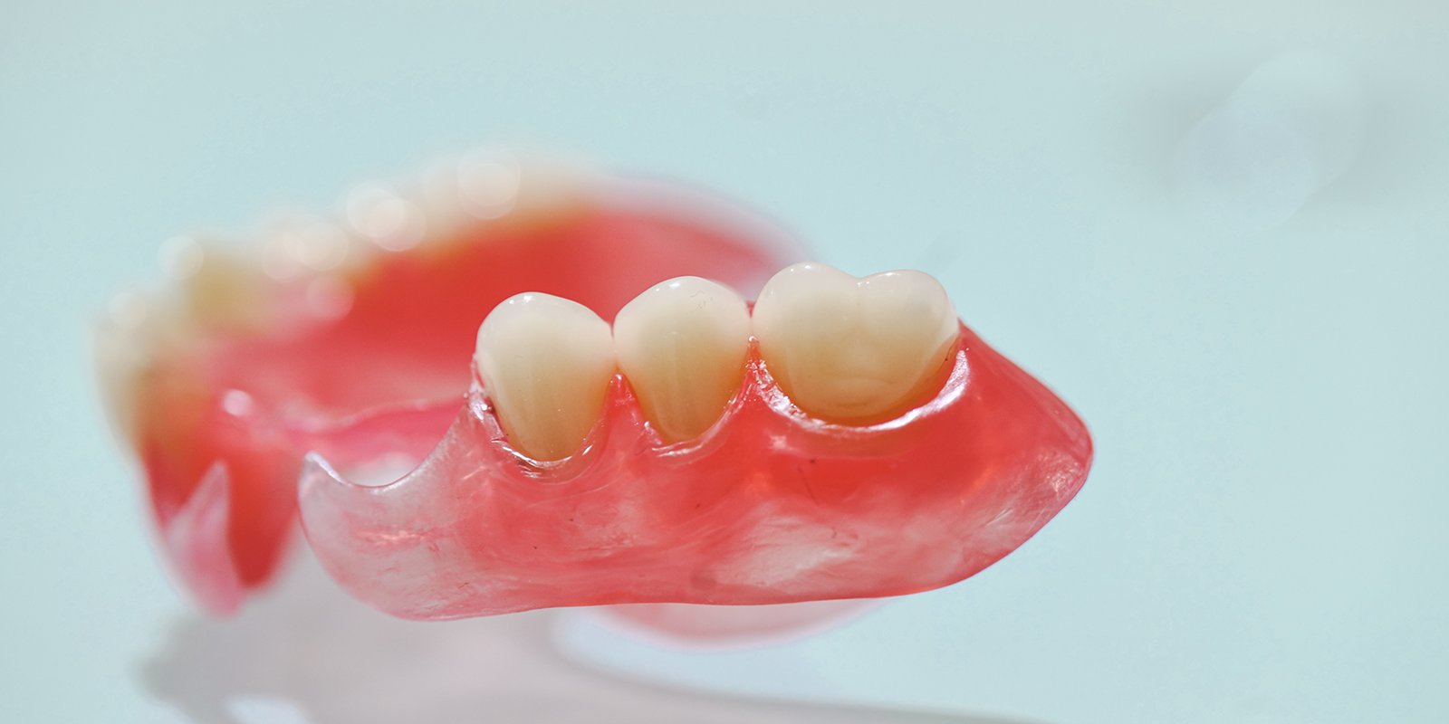 ノンクラスプデンチャー（自費診療）