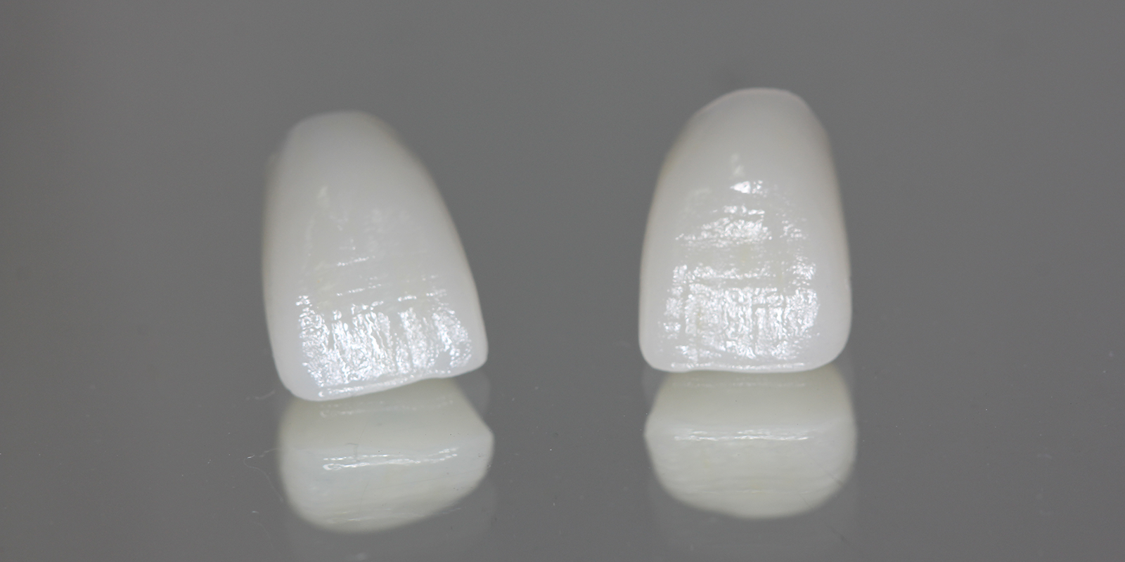 E-max（イーマックス／ニケイ酸リチウムガラス）