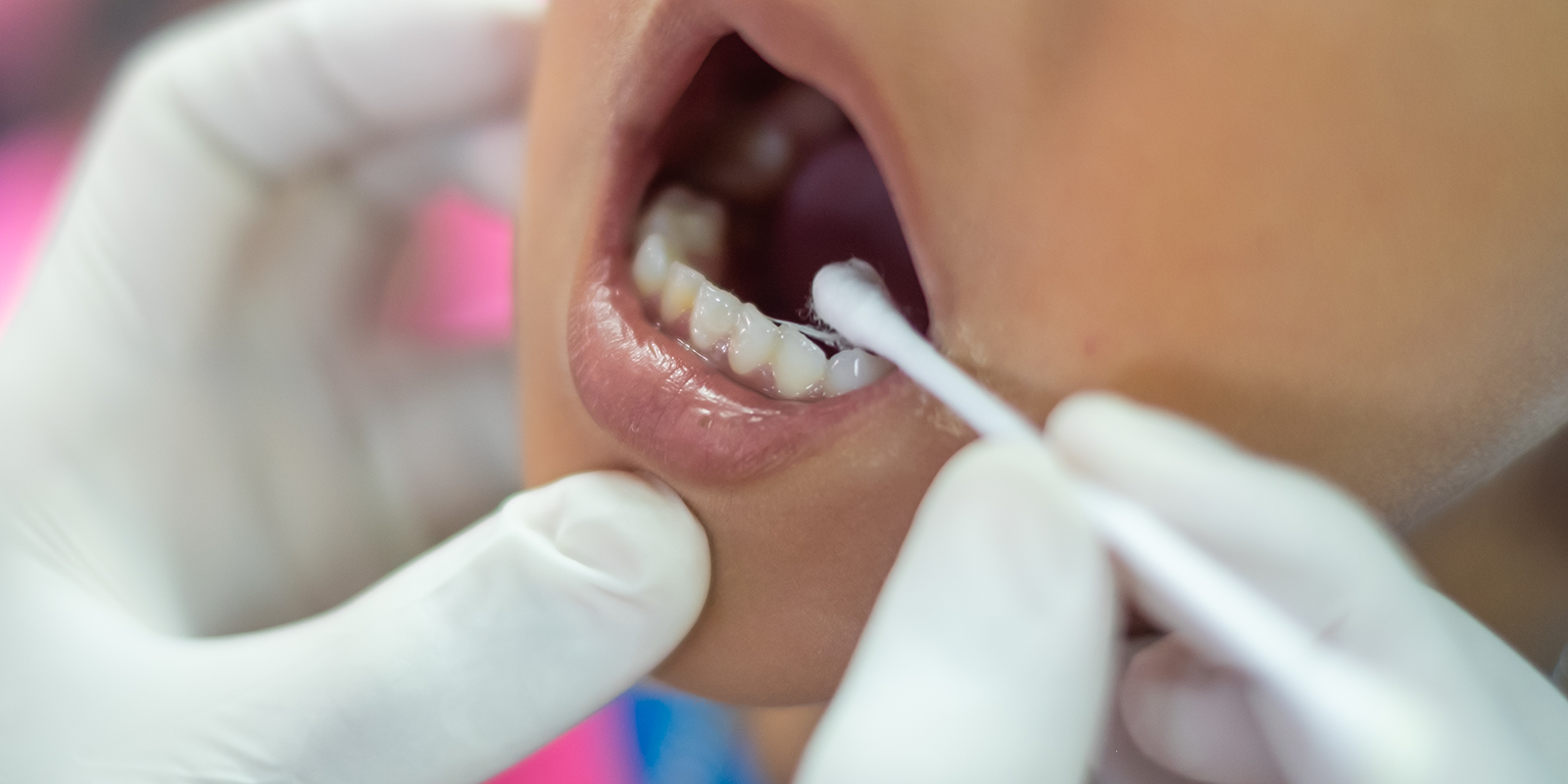 お子様の歯を守るメニュー