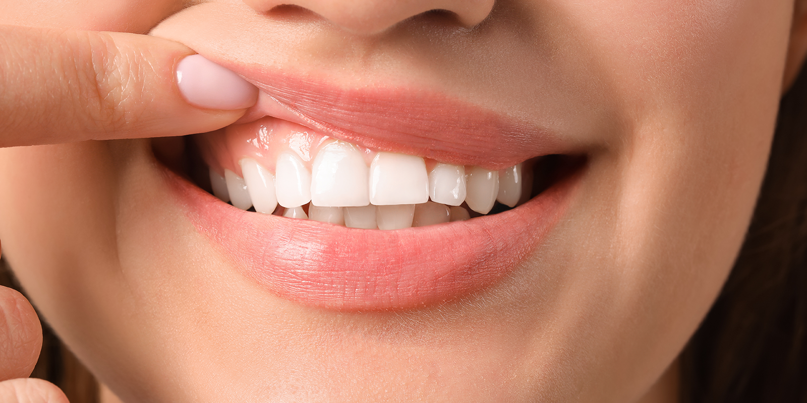 根管治療が必要な症状