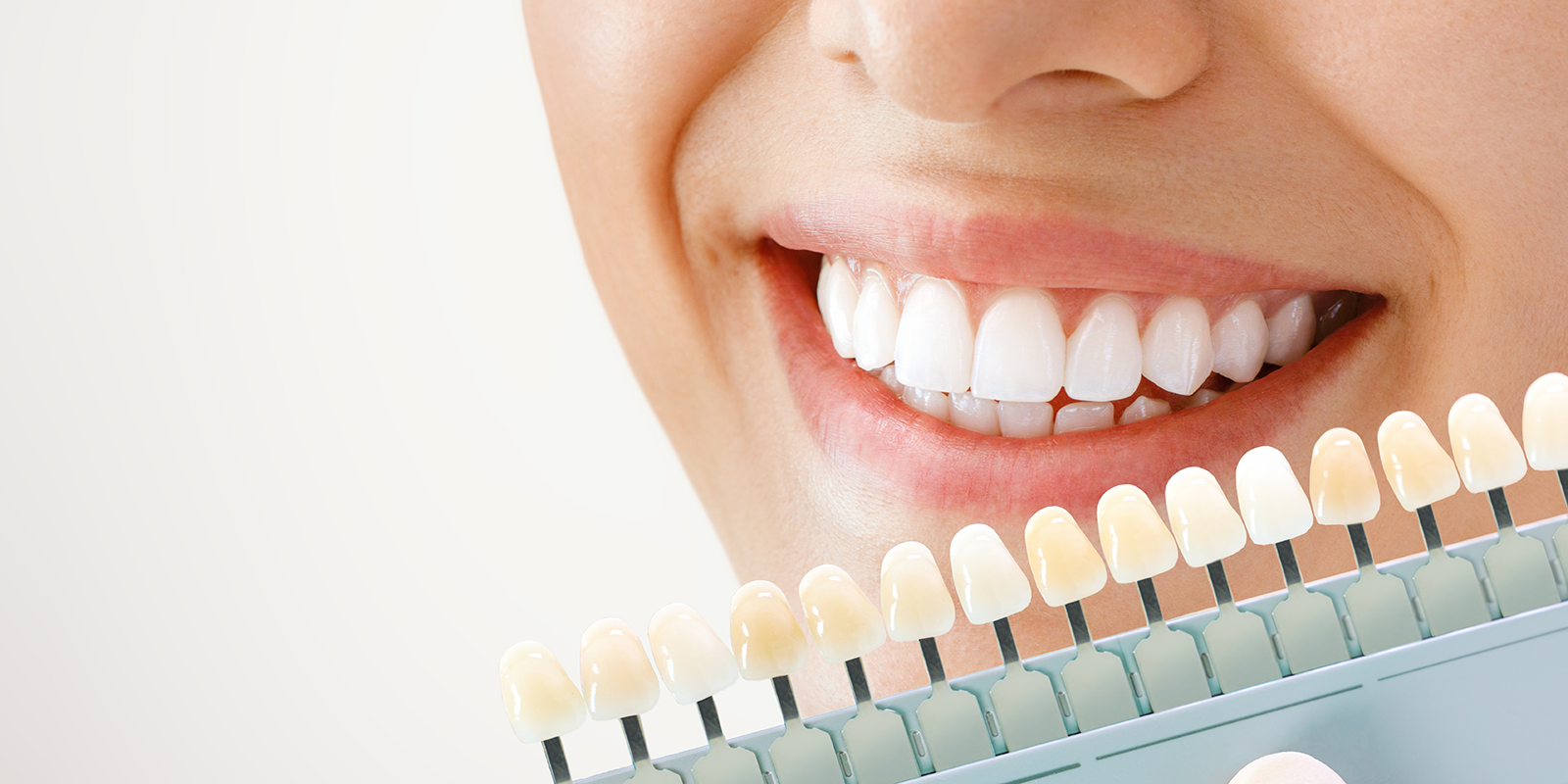 ホワイトニングで、自信あふれる毎日へ